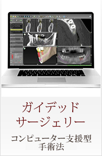 Menu03 ガイデッドサージェリー 安全で新しい手術法