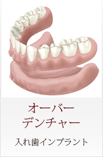 Menu04 オーバーデンチャー 入れ歯インプラント