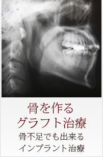 Menu05 骨を作るグラフト治療 骨不足でも出来るインプラント治療